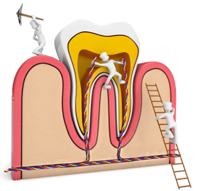 services-root-canal