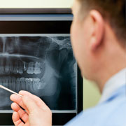 Рентгенодиагностика височно-нижнечелюстного сустава